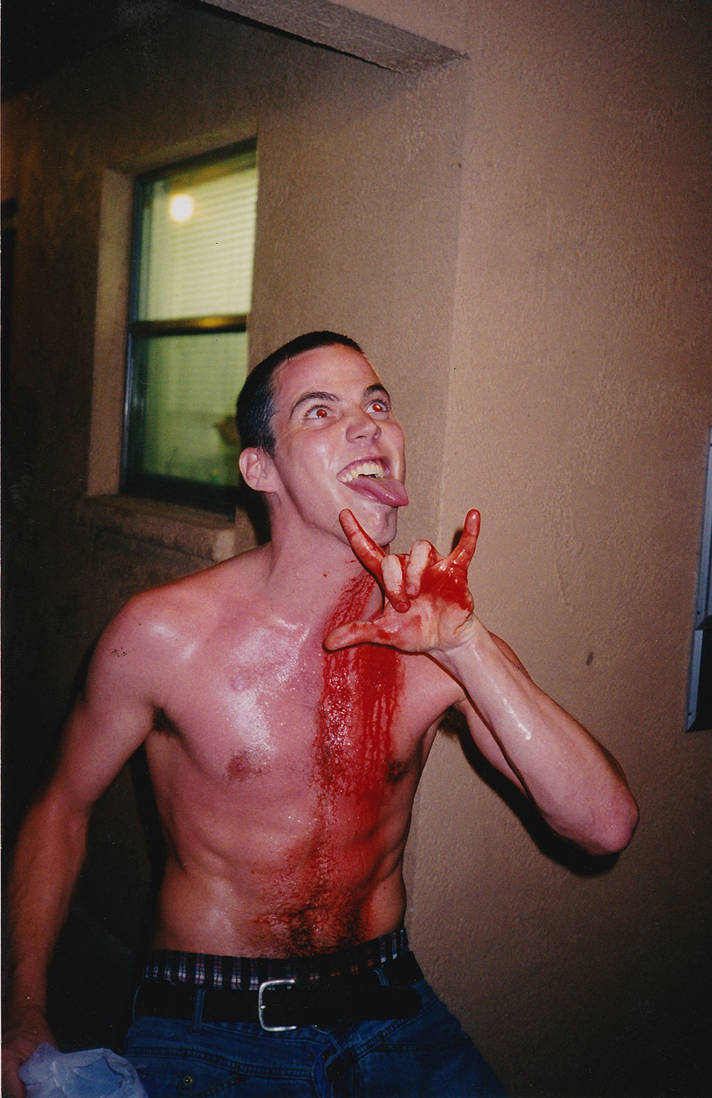 Steve-O with head injury. A white shirtless man sticks his tongue out and makes a hand signal as blood runs down his chest.